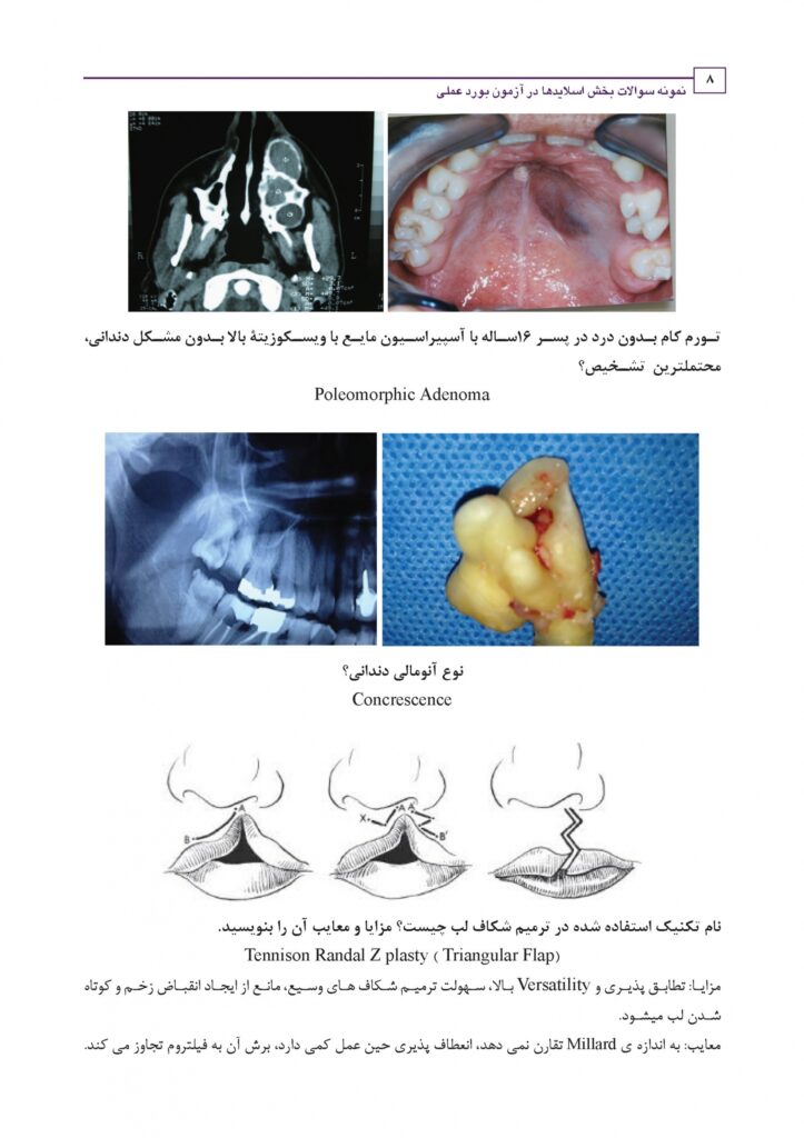 نمونه سوالات بخش اسلایدها در آزمون بورد عملی جراحی دهان، فک و صورت