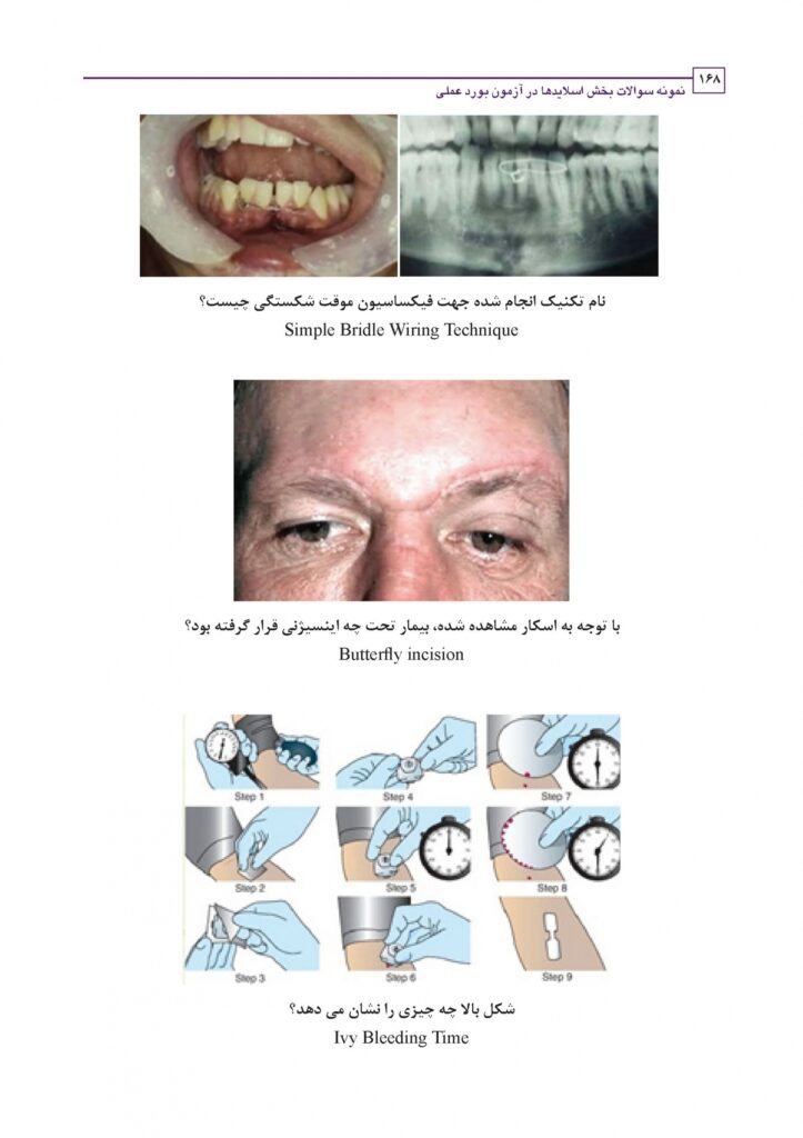 نمونه سوالات بخش اسلایدها در آزمون بورد عملی جراحی دهان، فک و صورت