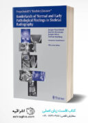 Freyschmidt’s “Koehler/Zimmer” Borderlands Of Normal And Early Pathological Findings In Skeletal Radiography | 5th Edition