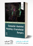 Computer-Assisted Planning In Craniofacial Surgery 1st Edition