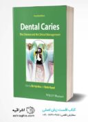 Dental Caries: The Disease And Its Clinical Management