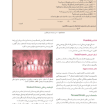 اصول نوین در پروتزهای ثابت دندانی رزنتال 2023 (جلد اول)